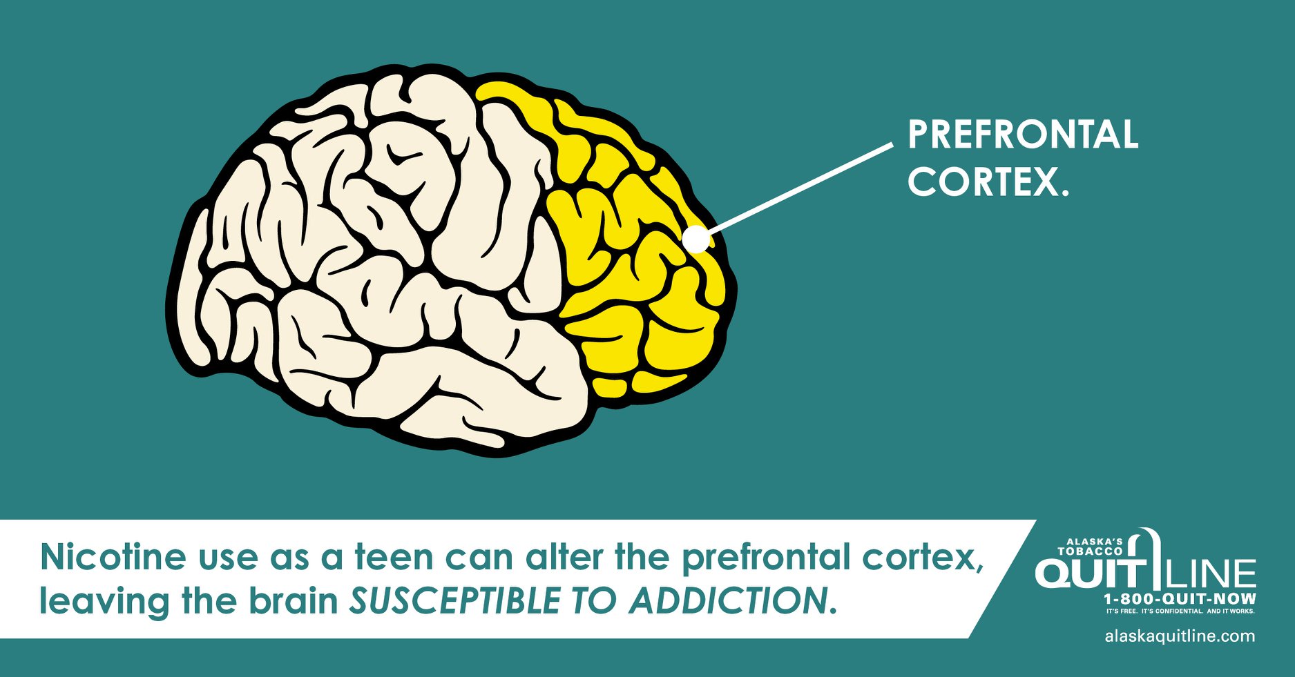 Illustration of a brain with the front highlighted and labeled, “prefrontal cortex.” The graphic reads, “Nicotine use as a teen can alter the prefrontal cortex, leaving the brain susceptible to addiction.”